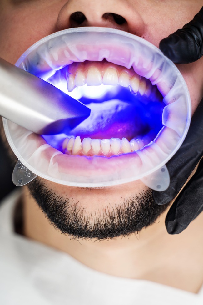 Prótesis dentales en Les Corts