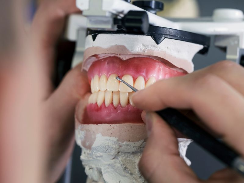 Prótesis dentales en Les Corts